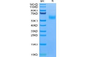 Mouse EDA2R on Tris-Bis PAGE under reduced condition. (Ectodysplasin A2 Receptor Protein (EDA2R) (AA 1-138) (Fc Tag))