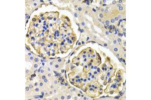 Immunohistochemistry of paraffin-embedded rat kidney using KLKB1 antibody (ABIN2975433) at dilution of 1/200 (40x lens). (KLKB1 抗体)