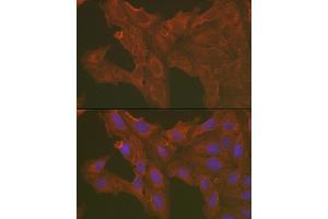 Immunofluorescence analysis of U2OS cells using [KO Validated] Caspase-3 Rabbit pAb (ABIN6131582, ABIN6137962, ABIN6137964 and ABIN6215049) at dilution of 1:100 (40x lens). (Caspase 3 抗体  (AA 55-160))