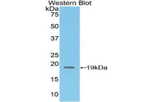 Detection of Recombinant CD97, Mouse using Polyclonal Antibody to Cluster Of Differentiation 97 (CD97) (CD97 抗体  (AA 32-173))