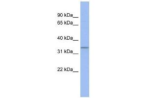 C17ORF78 antibody used at 1 ug/ml to detect target protein. (C17orf78 抗体  (Middle Region))