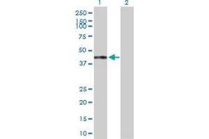 Western Blot analysis of TRAF1 expression in transfected 293T cell line by TRAF1 MaxPab polyclonal antibody. (TRAF1 抗体  (AA 1-416))