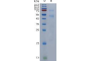 Human Protein, His Tag on SDS-PAGE under reducing condition. (BMP6 Protein (AA 21-513) (His tag))