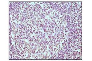 Immunohistochemistry (IHC) image for anti-CD19 Molecule (CD19) antibody (ABIN1105970) (CD19 抗体)