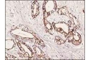 Immunohistochemistry (IHC) image for anti-Keratin 7 (KRT7) (C-Term) antibody (ABIN870438) (Cytokeratin 7 抗体  (C-Term))