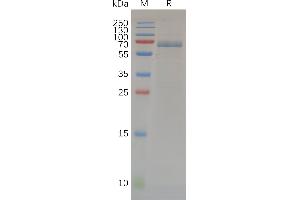 MMP14 Protein (AA 112-541) (Fc Tag)