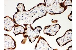 IHC-P: SERPINB2 antibody testing of human placenta tissue (SERPINB2 抗体  (AA 1-180))