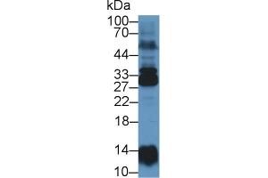 Western Blot; Sample: Human Lung lysate; Primary Ab: 1µg/ml Rabbit Anti-Human NME6 Antibody Second Ab: 0. (Non Metastatic Cells 6, Protein Expressed In (AA 3-182) 抗体)