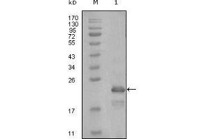 Western Blot showing HAND1 antibody used against truncated Trx-HAND1 recombinant protein (1). (HAND1 抗体  (AA 90-190))