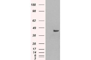 Western Blotting (WB) image for anti-Sorting Nexin 16 (SNX16) antibody (ABIN5877322) (SNX16 抗体)