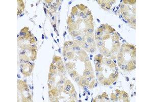 Immunohistochemistry of paraffin-embedded Human stomach using CBR4 Polyclonal Antibody at dilution of 1:100 (40x lens). (CBR4 抗体)