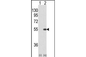 Western blot analysis of STK40 (arrow) using rabbit polyclonal STK40 (C-term) (ABIN652973 and ABIN2842617). (STK40 抗体  (C-Term))