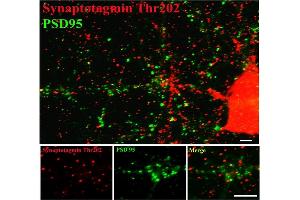 Image no. 2 for anti-Synaptotagmin I (SYT1) (pThr202) antibody (ABIN372724) (SYT1 抗体  (pThr202))