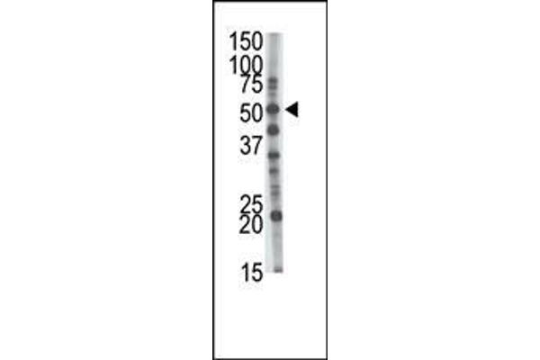 GCNT1 抗体  (AA 88-117)