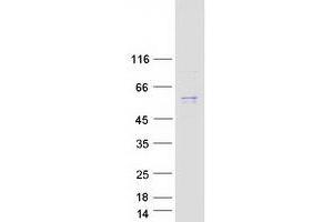 Validation with Western Blot (PPARG Protein (Transcript Variant 1) (Myc-DYKDDDDK Tag))