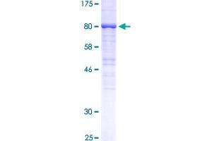 Image no. 1 for Epidermal Growth Factor Receptor (EGFR) (AA 669-1210) protein (GST tag) (ABIN1352441) (EGFR Protein (AA 669-1210) (GST tag))