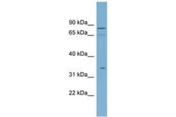 SLC5A9 抗体  (N-Term)