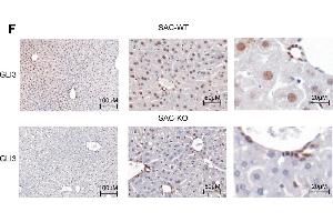 Immunohistochemistry (IHC) image for anti-GLI Family Zinc Finger 3 (GLI3) antibody (ABIN2855813)