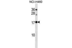 RPL12 Antibody (Center) western blot analysis in NCI-H460 cell line lysates (35µg/lane). (RPL12 抗体  (Middle Region))