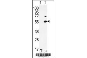 Western blot analysis of PRMT2 using rabbit polyclonal PRMT2 Antibody (A37) using 293 cell lysates (2 ug/lane) either nontransfected (Lane 1) or transiently transfected (Lane 2) with the PRMT2 gene. (PRMT2 抗体  (N-Term))