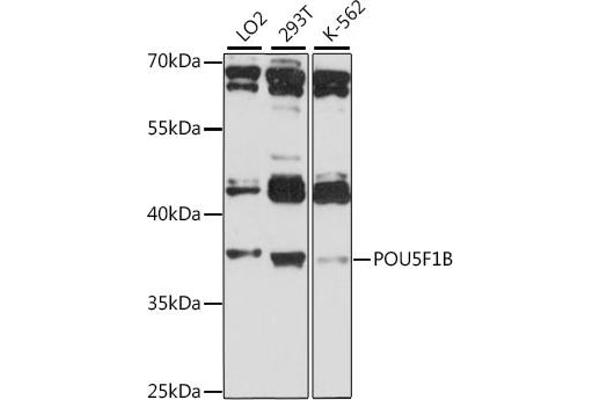 POU5F1B 抗体  (AA 1-140)
