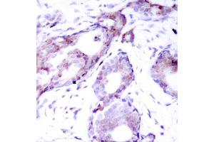Immunohistochemistry (IHC) image for anti-Myc Proto-Oncogene protein (MYC) (pSer373) antibody (ABIN1870452) (c-MYC 抗体  (pSer373))