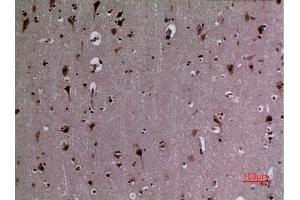 Immunohistochemical analysis of paraffin-embedded human-brain, antibody was diluted at 1:100. (HSP90 抗体  (acLys284, acLys292))