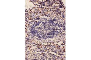 Immunohistochemistry (IHC) image for anti-CD68 Molecule (CD68) (AA 312-326), (Middle Region) antibody (ABIN3044428)