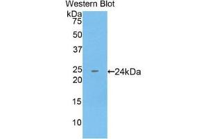 Western Blotting (WB) image for anti-Keratin 18 (KRT18) (AA 238-396) antibody (ABIN1859576) (Cytokeratin 18 抗体  (AA 238-396))