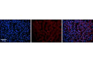 Rabbit Anti-TEAD4 Antibody    Formalin Fixed Paraffin Embedded Tissue: Human Adult liver  Observed Staining: Nuclear in endothelial cells not in hepatocytes Primary Antibody Concentration: 1:600 Secondary Antibody: Donkey anti-Rabbit-Cy2/3 Secondary Antibody Concentration: 1:200 Magnification: 20X Exposure Time: 0. (TEAD4 抗体  (N-Term))