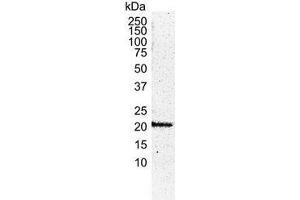 Western Blotting (WB) image for anti-HRas proto-oncogene, GTPase (HRAS) antibody (ABIN2473919) (HRAS 抗体)