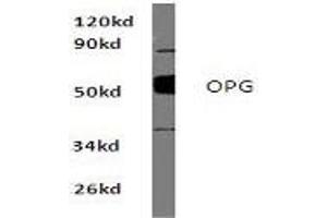 Image no. 1 for anti-Tumor Necrosis Factor Receptor Superfamily, Member 11b (TNFRSF11B) antibody (ABIN272130) (Osteoprotegerin 抗体)