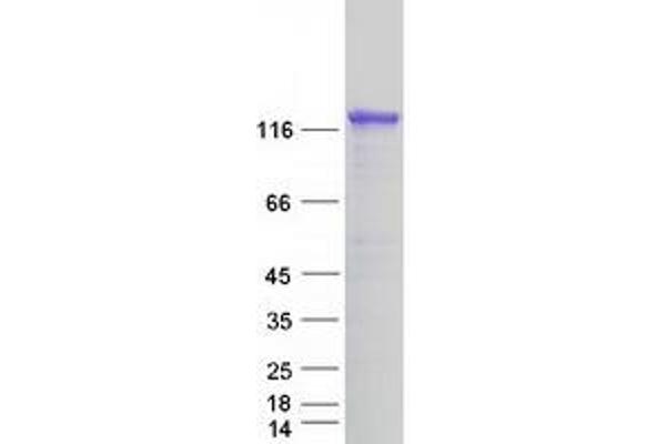 DAB2IP Protein (Transcript Variant 1) (Myc-DYKDDDDK Tag)