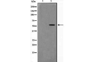 Western blot analysis on 293 cell lysate using AKT1 Antibody，The lane on the left is treated with the antigen-specific peptide. (AKT1 抗体  (C-Term))