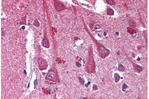 Human Brain, Cortex (formalin-fixed, paraffin-embedded) stained with CXCR4 antibody ABIN301627 at 10 ug/ml followed by biotinylated anti-mouse IgG secondary antibody ABIN481714, alkaline phosphatase-streptavidin and chromogen. (CXCR4 抗体)