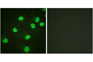 Immunofluorescence analysis of HeLa cells, using Histone H4 (Acetyl-Lys5) Antibody. (Histone H4 抗体  (acLys5))