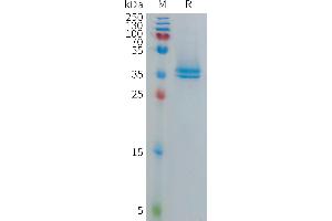 Human T Protein, hFc Tag on SDS-PAGE under reducing condition. (FAM19A5 Protein (AA 44-132) (Fc Tag))