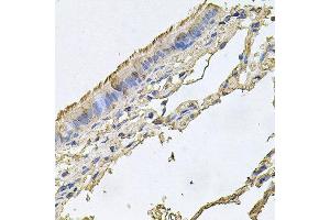 Immunohistochemistry of paraffin-embedded human trachea using FABP12 antibody at dilution of 1:100 (x40 lens). (FABP12 抗体)