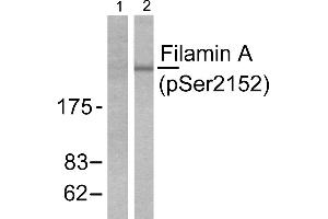 Western blot analysis of extracts from 293 cells treated with EGF (200ng/ml, 5mins), using Filamin A (phospho-Ser2152) antibody. (Filamin A 抗体  (pSer2152))