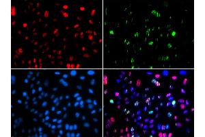 Immunofluorescence (IF) image for anti-Tumor Protein P53 (TP53) (pSer15) antibody (ABIN1870674) (p53 抗体  (pSer15))