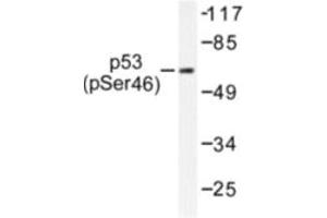 Image no. 1 for anti-Tumor Protein P53 (TP53) (pSer46) antibody (ABIN318094) (p53 抗体  (pSer46))