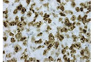 Immunohistochemistry (IHC) image for Goat anti-Rabbit IgG (Heavy & Light Chain) antibody (APC) - Preadsorbed (ABIN375800)