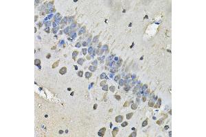 Immunohistochemistry of paraffin-embedded rat brain using MYH1 Antibody (ABIN2563998) at dilution of 1:100 (40x lens). (MYH1 抗体)