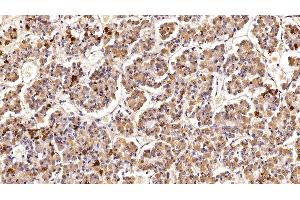 Detection of PRL in Porcine Pituitary Tissue using Polyclonal Antibody to Prolactin (PRL) (Prolactin 抗体  (AA 31-229))