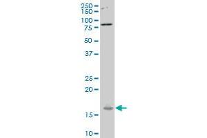 RPS23 polyclonal antibody (A01), Lot # SUH1060317QCS1 Western Blot analysis of RPS23 expression in Hela S3 NE . (RPS23 抗体  (AA 44-143))