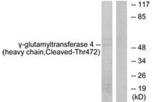 Western blot analysis of extracts from Jurkat cells, treated with etoposide 25uM 24h, using Gamma-glutamyltransferase 4 (heavy chain,Cleaved-Thr472) Antibody. (GGT7 抗体  (Cleaved-Thr472))