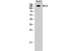 Western Blotting (WB) image for anti-Nitric Oxide Synthase 3 (Endothelial Cell) (NOS3) (Thr180) antibody (ABIN3180214) (ENOS 抗体  (Thr180))