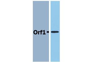 Western Blotting analysis (reducing conditions) of recombinant protein Orf1 in cell lysate of Orf1-transfected E. (Neisseria Meningitidis Antigen Orf1 抗体)