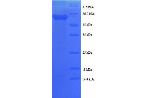 Cathepsin D Protein (CTSD) (AA 67-403, partial) (GST tag)