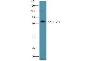HepG2 lysate probed with Rabbit Anti-AKT1+2+3 Polyclonal Antibody (ABIN1387781) at 1:300 overnight in 4 °C. (AKT 1/2/3 抗体  (AA 401-480))
